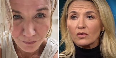 Kristin Kaspersen tvingas in till sjukhuset – måste ta det lugnt med sitt ben enligt läkarnas order: "Skit"