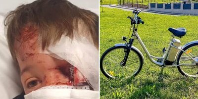 Carter, 10, blev påkörd av elcykel utanför sitt hem – "Det var blod överallt"